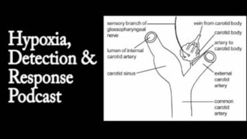 Private: [ID: 93hutERU2b8] Youtube Automatic