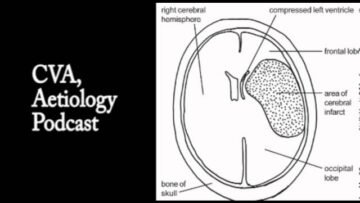 Private: [ID: AuluWop4TWQ] Youtube Automatic