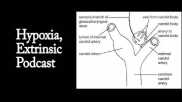 Private: [ID: g7ttuzo3ET0] Youtube Automatic