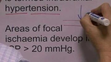 Private: [ID: _l6FSRLt4PM] Youtube Automatic