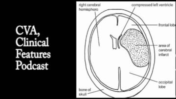 Private: [ID: SDD38bluXlM] Youtube Automatic