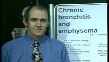 Private: [ID: WhvzdeMc9iU] Youtube Automatic